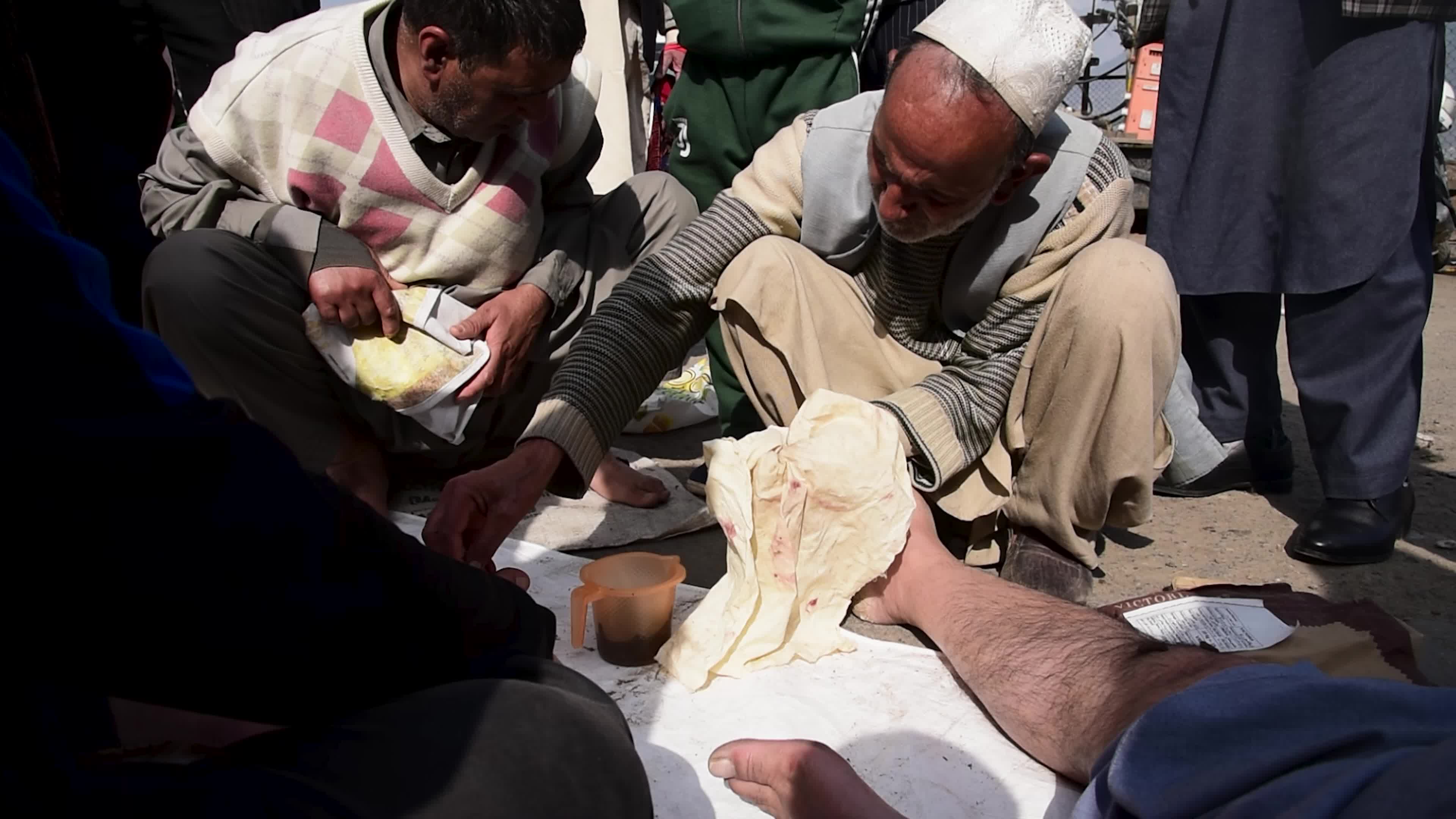 Bloodletting with Leeches in Indian administered Kashmir