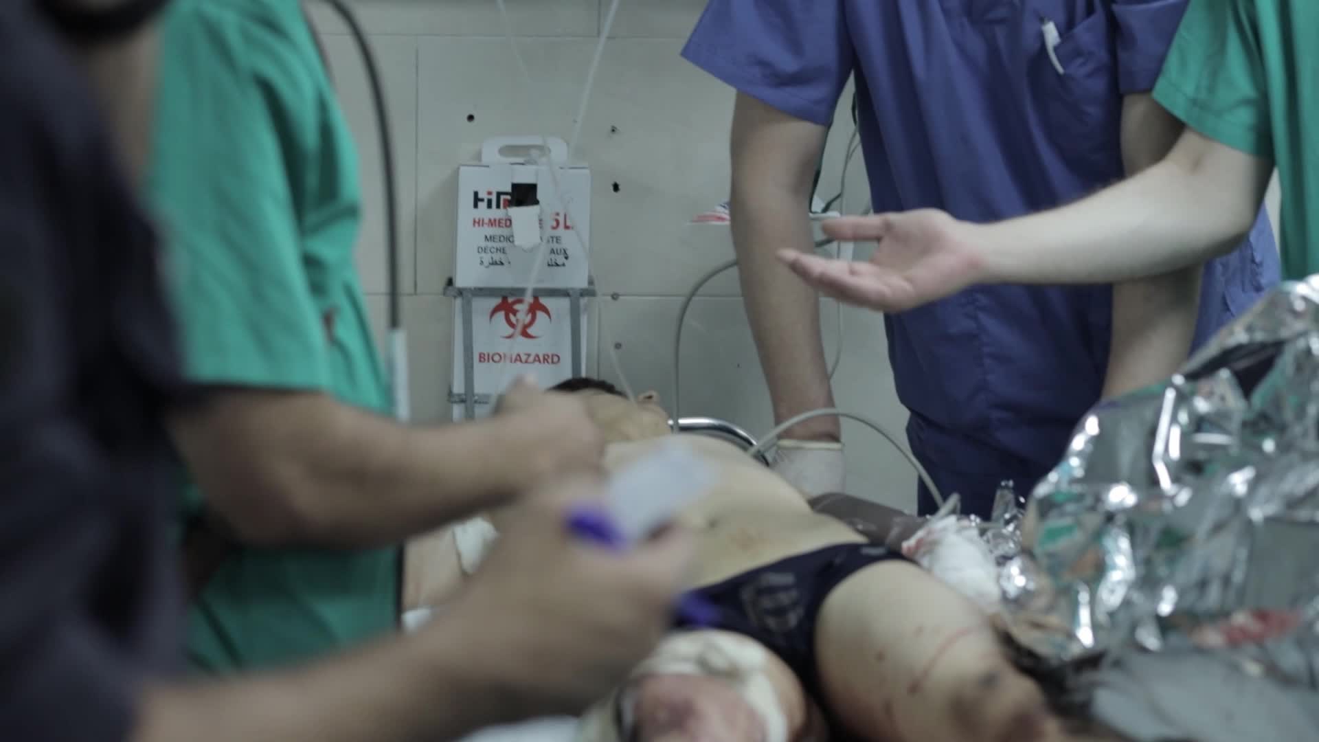 Wounded Palestinians At Shifa Hospital Following Israeli Air Strike