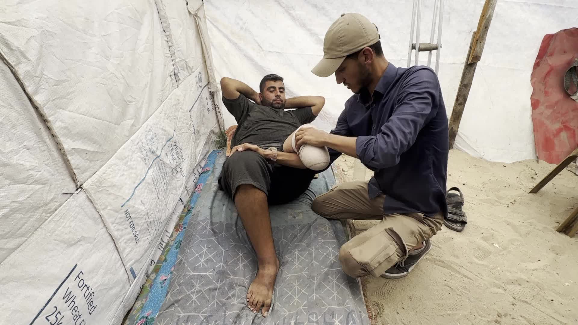Displaced Palestinian Receives Prosthetic Limb Amid Hamas-Israel Conflict