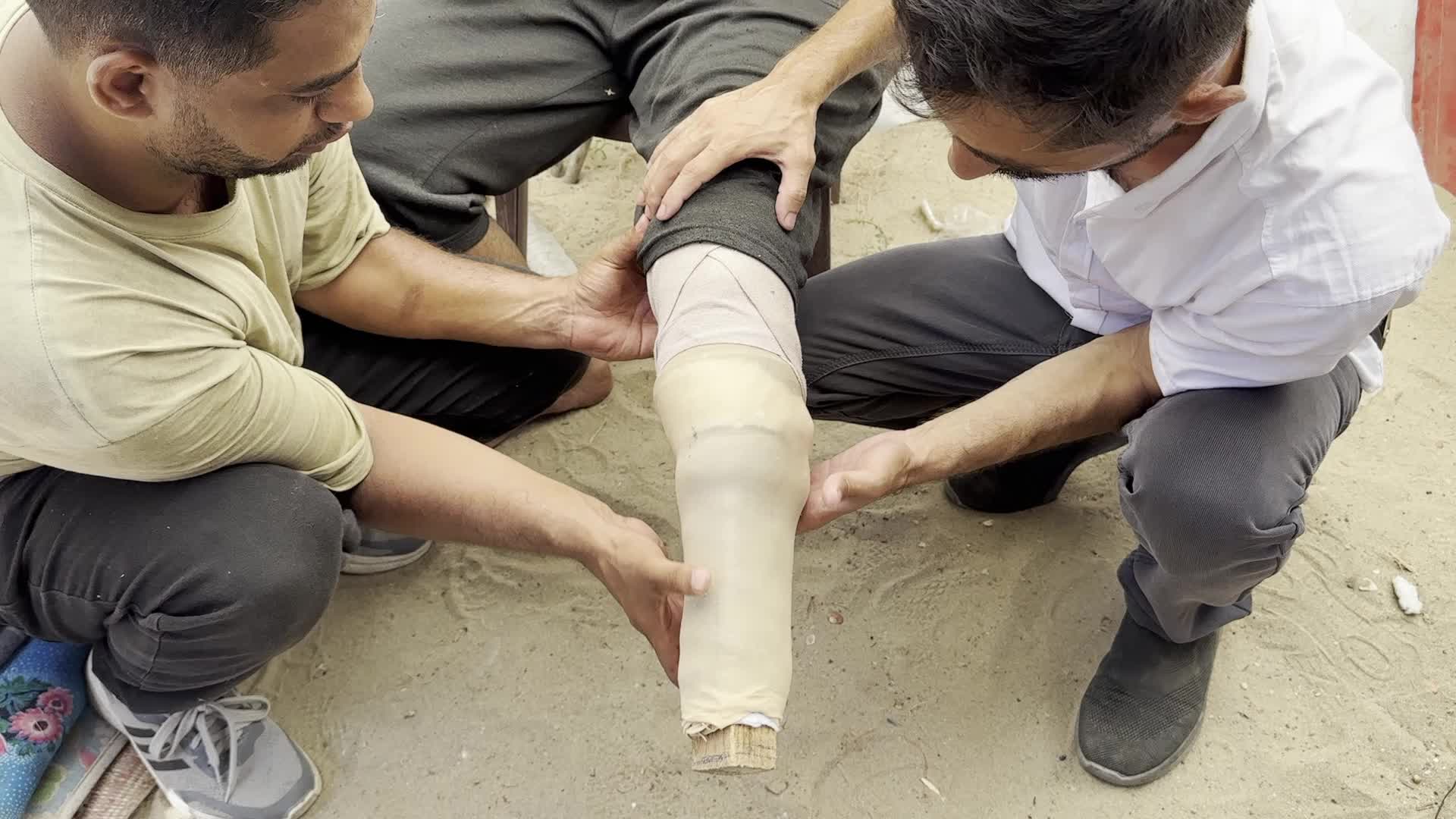Displaced Palestinian Receives Prosthetic Limb Amid Hamas-Israel Conflict