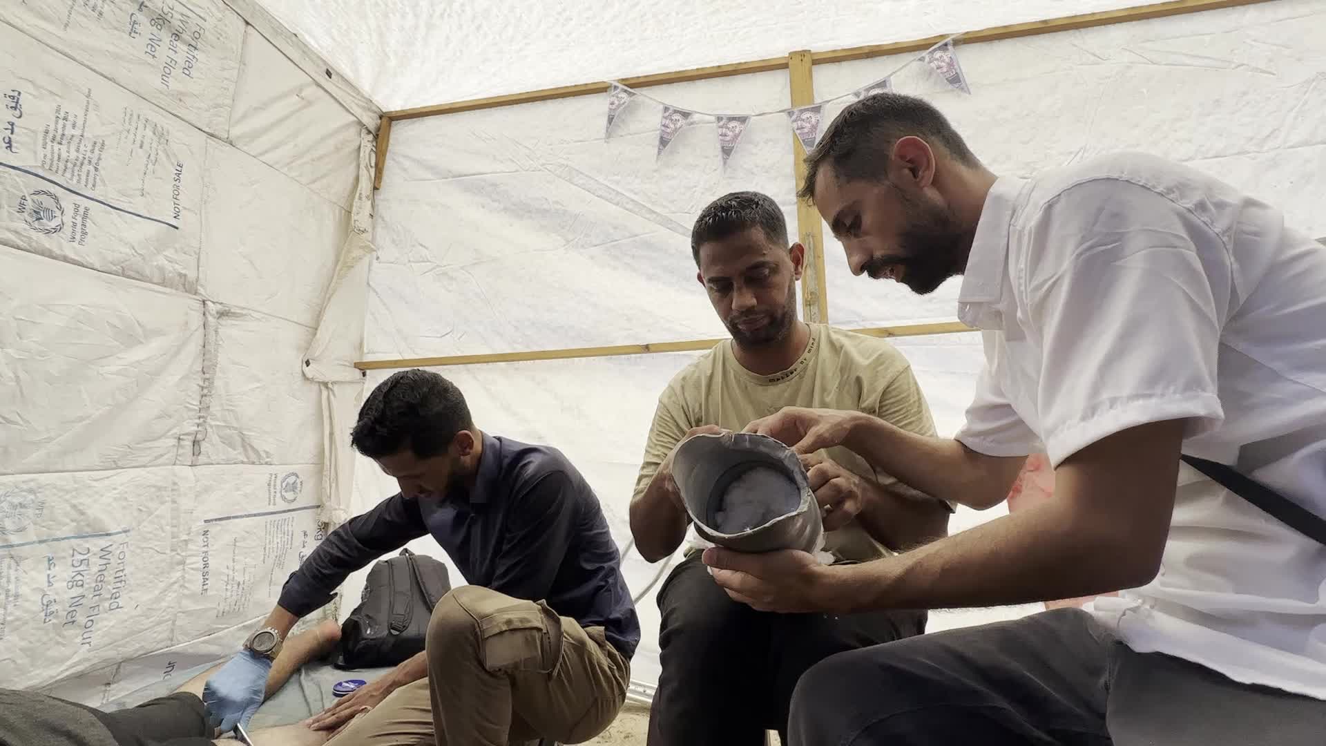 Displaced Palestinian Receives Prosthetic Limb Amid Hamas-Israel Conflict