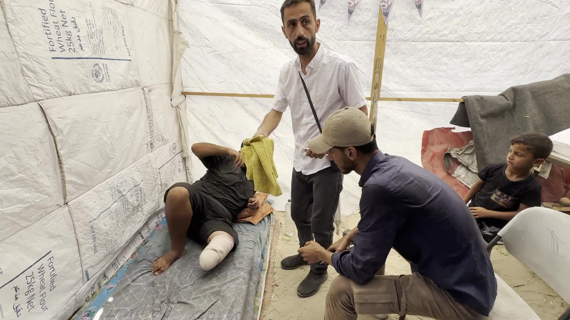Displaced Palestinian Receives Prosthetic Limb Amid Hamas-Israel Conflict