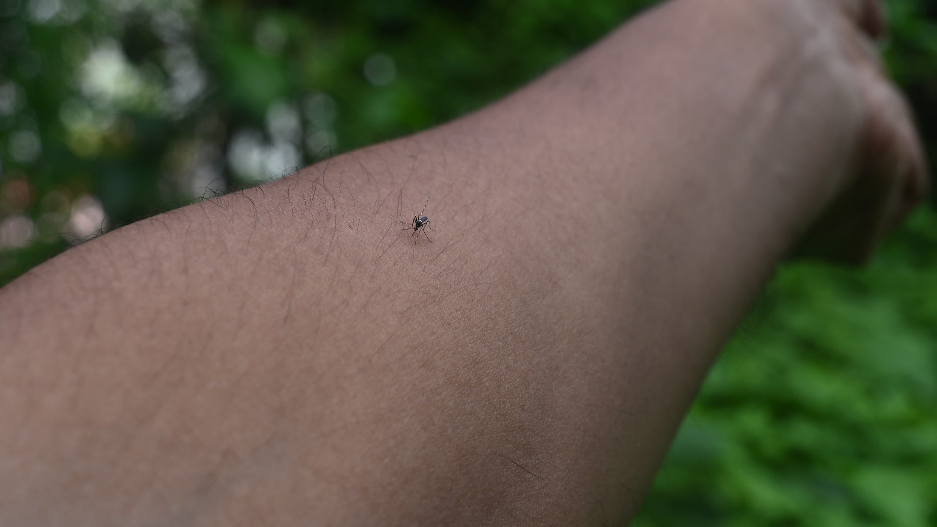 Asian tiger mosquito - Aedes albopictus - Mosquito bites
