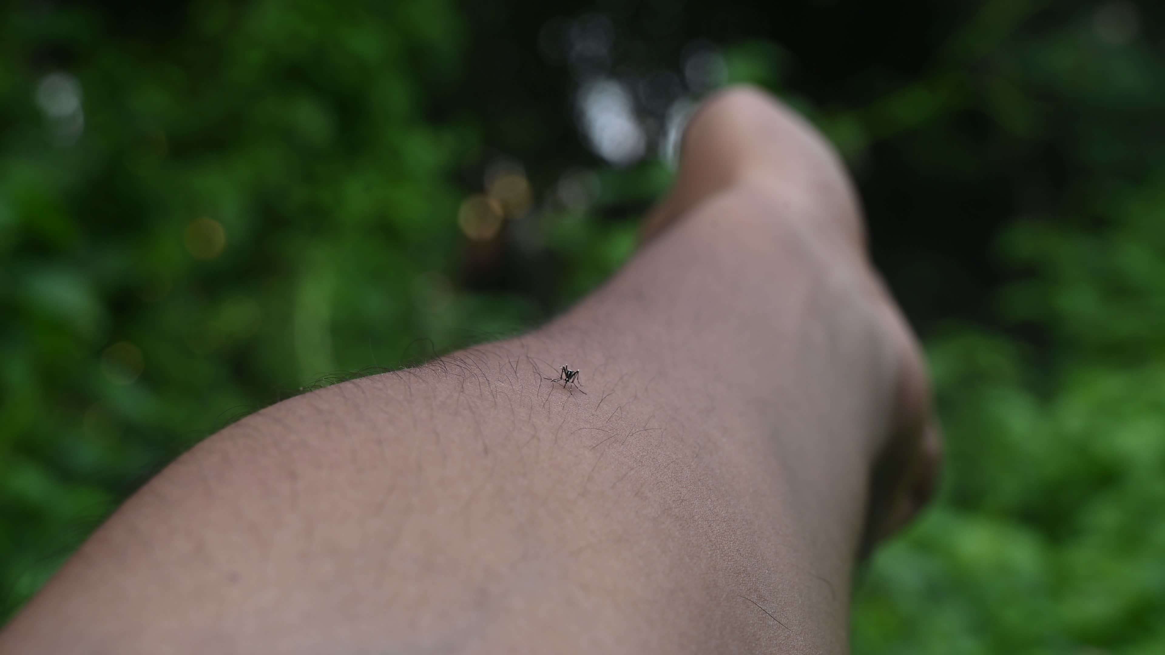  Asian tiger mosquito - Aedes albopictus - Mosquito bites
