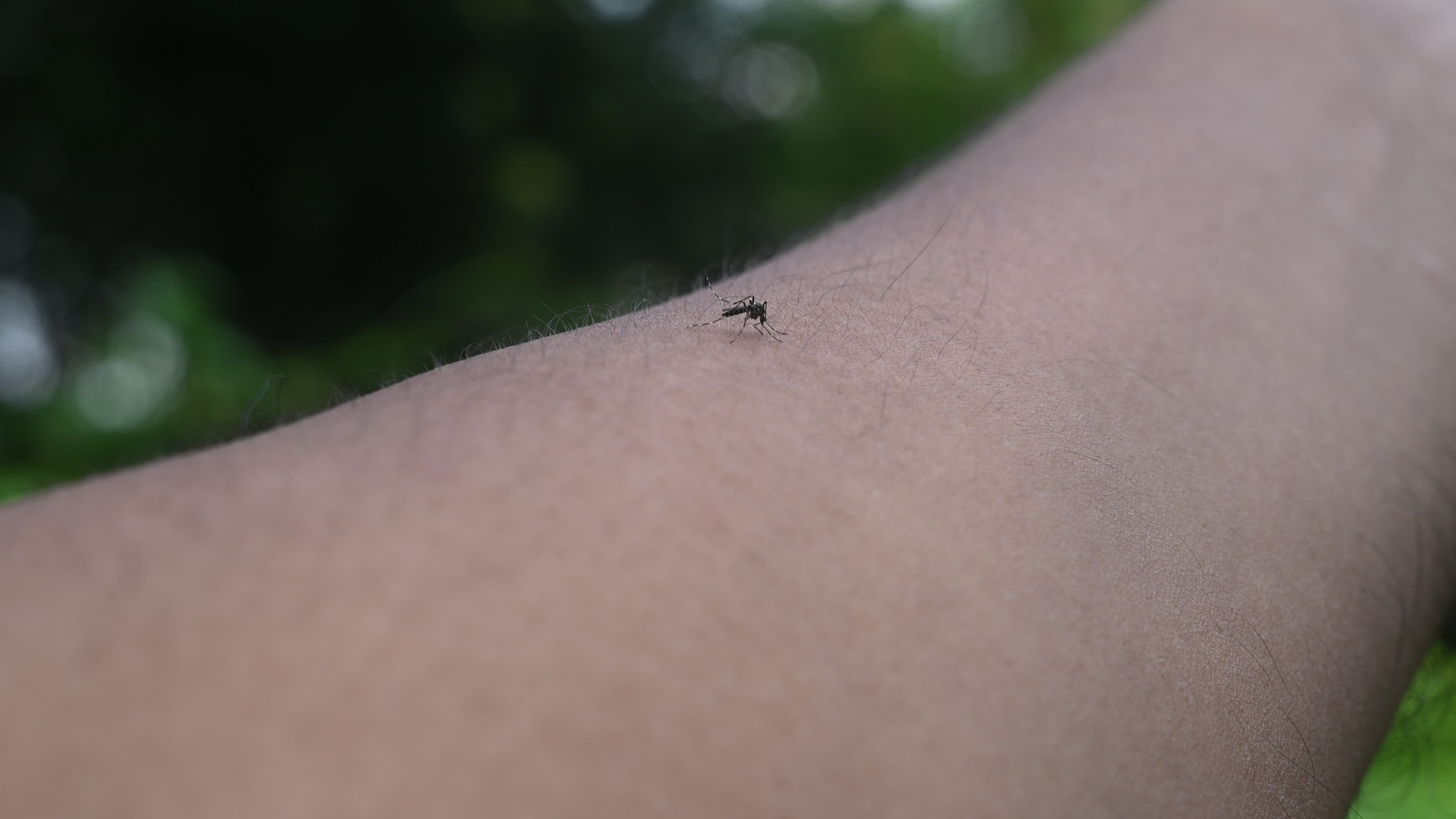  Asian tiger mosquito - Aedes albopictus - Mosquito bites
