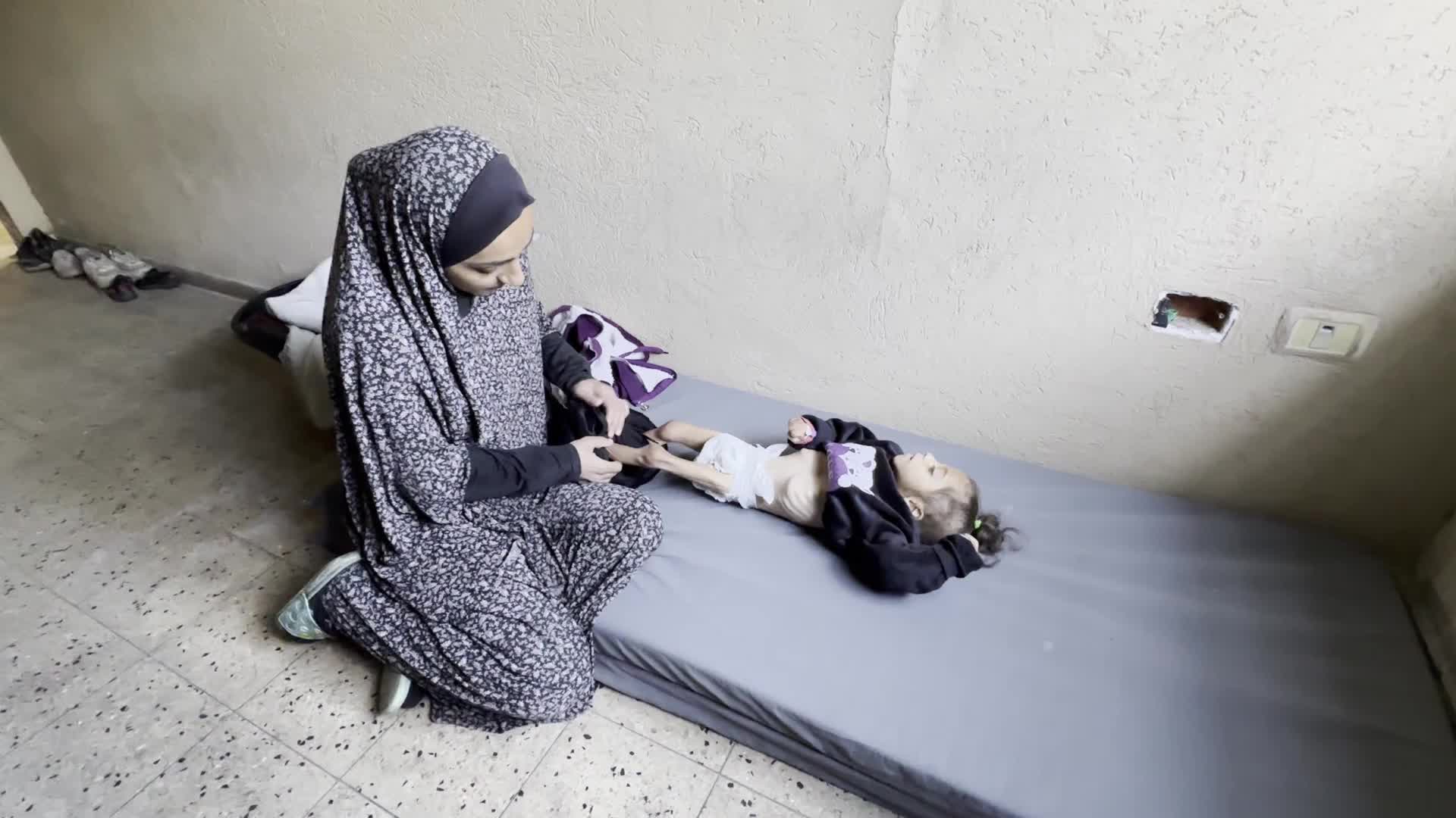 Malnutrition In Gaza Amid Hamas-Israel Conflict