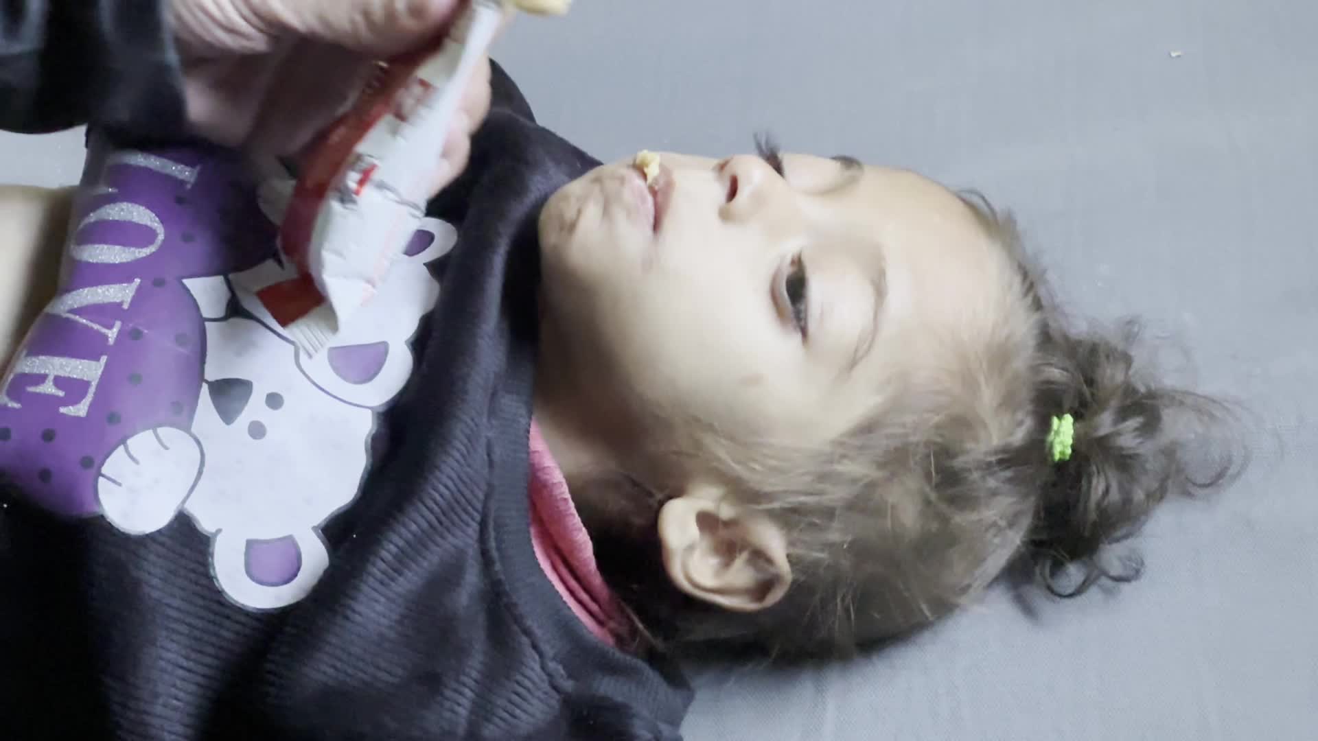 Malnutrition In Gaza Amid Hamas-Israel Conflict