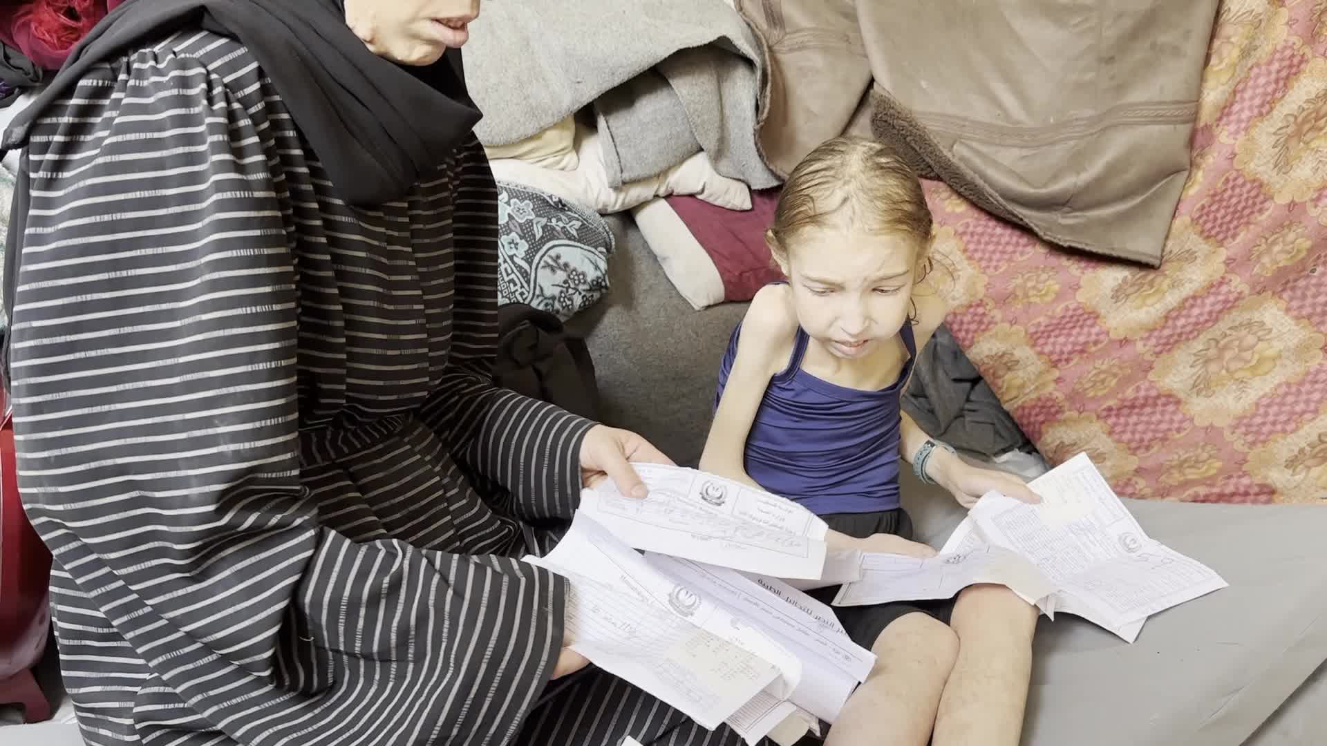 Malnutrition Crisis In Gaza Amid Hamas-Israel Confilct