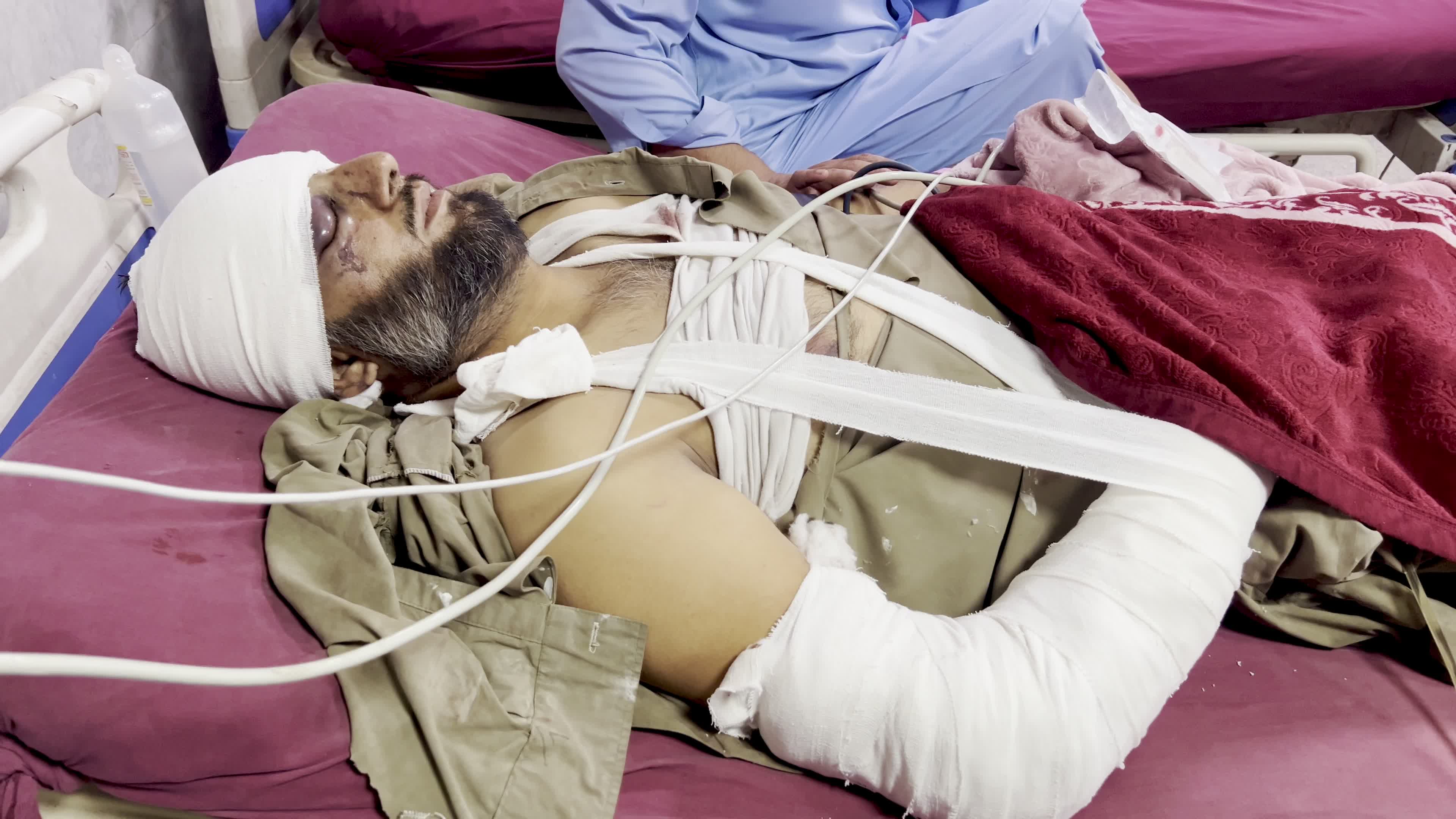 Blast victim receive treatment at a hospital in Peshawar