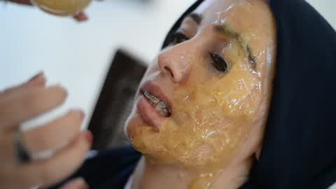 Campaigning to support cancer patients For marriage in Gaza City