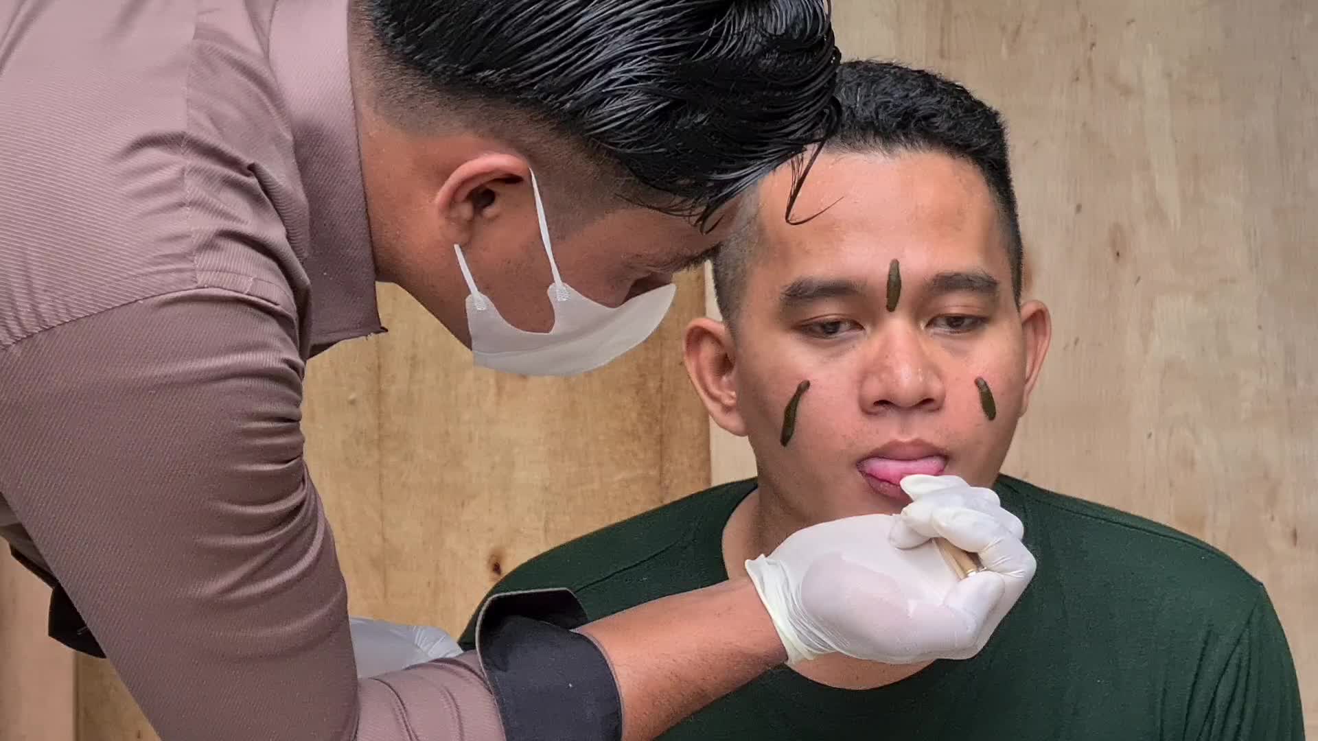 Leeches Therapy during Covid-19 Pandemic