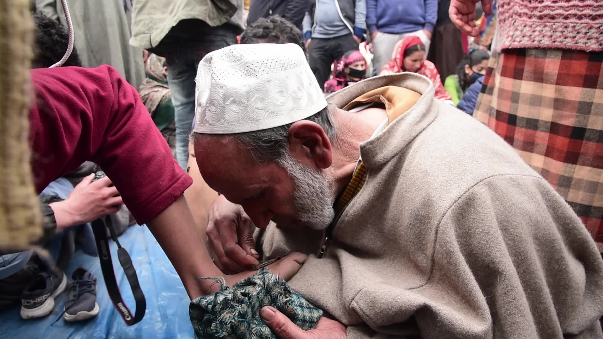 Leech treatment in Srinagar