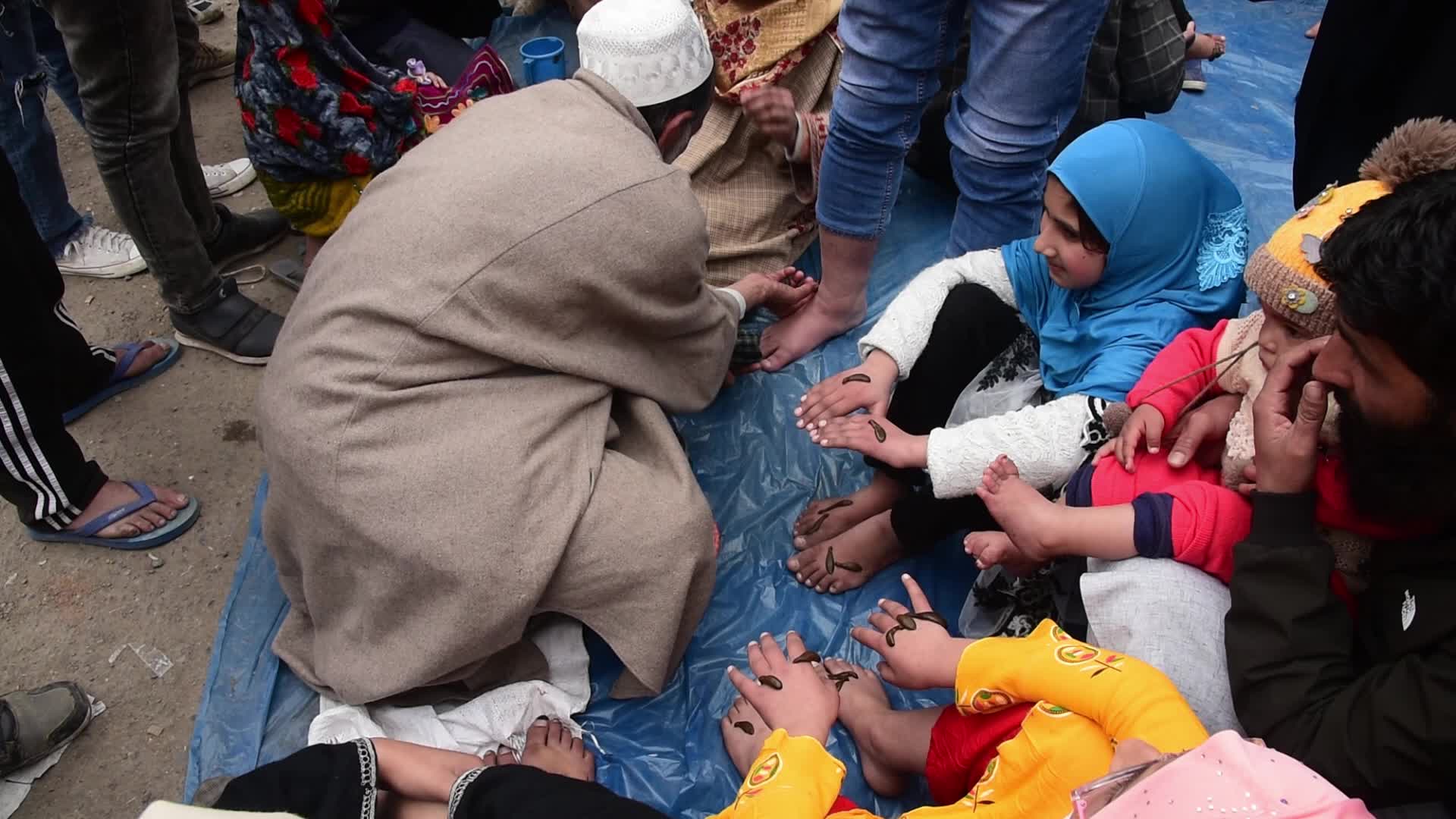 Leech treatment in Srinagar