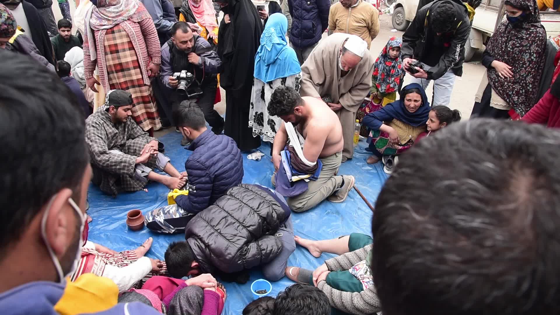 Leech treatment in Srinagar