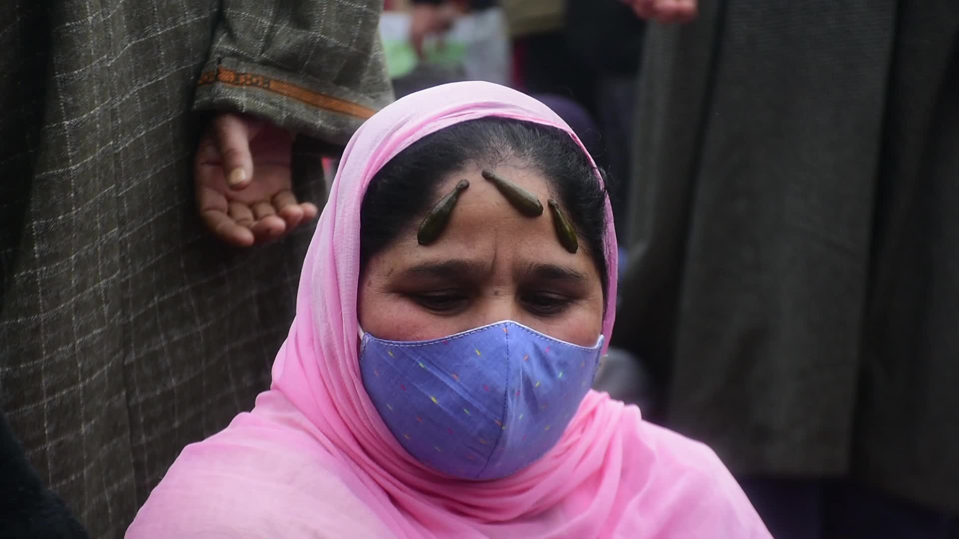 Leech Therapy in Kashmir