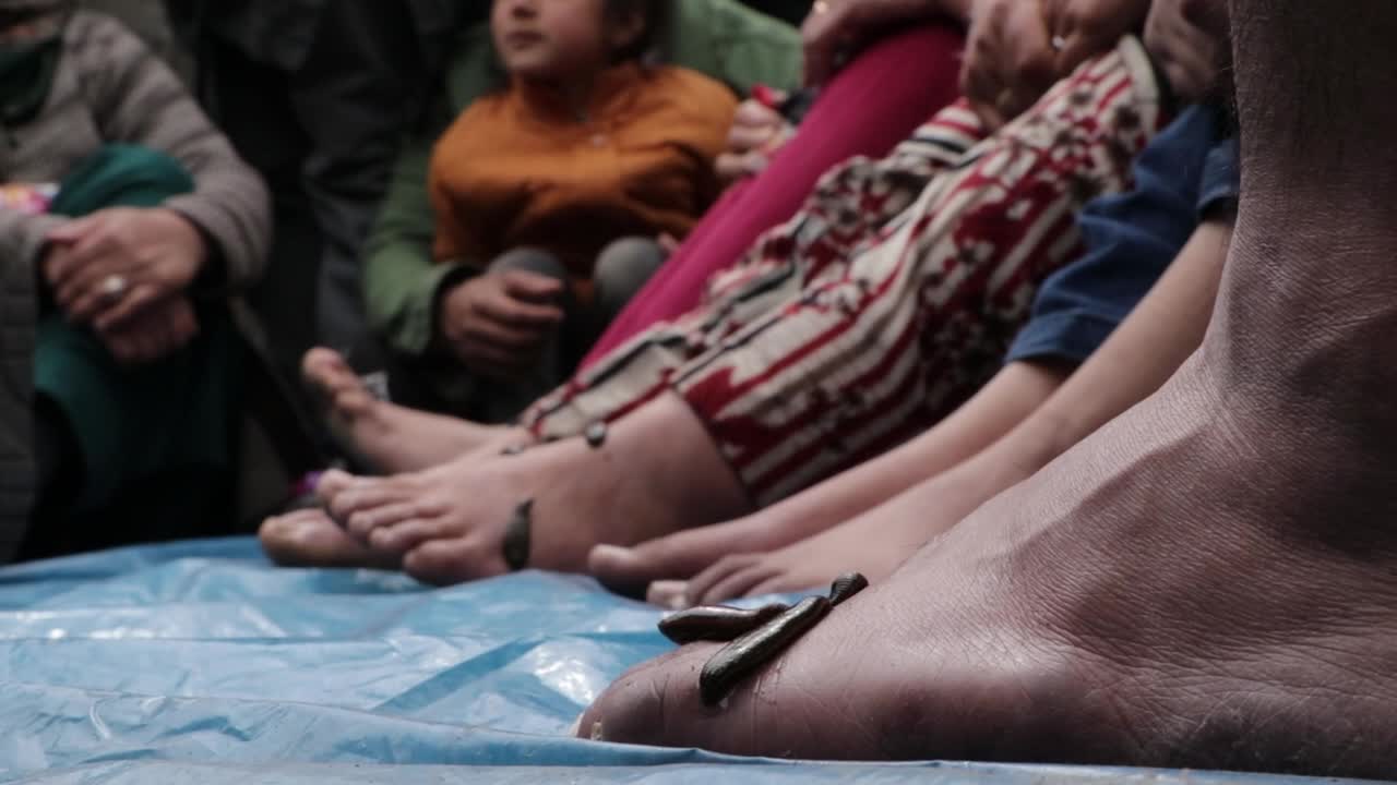 Leech Therapy Marks Nowruz In Kashmir
