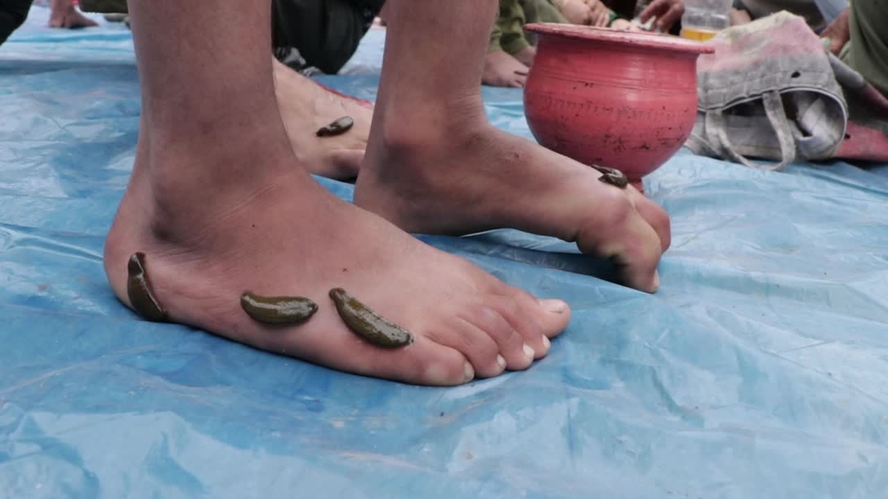 Leech Therapy Marks Nowruz In Kashmir
