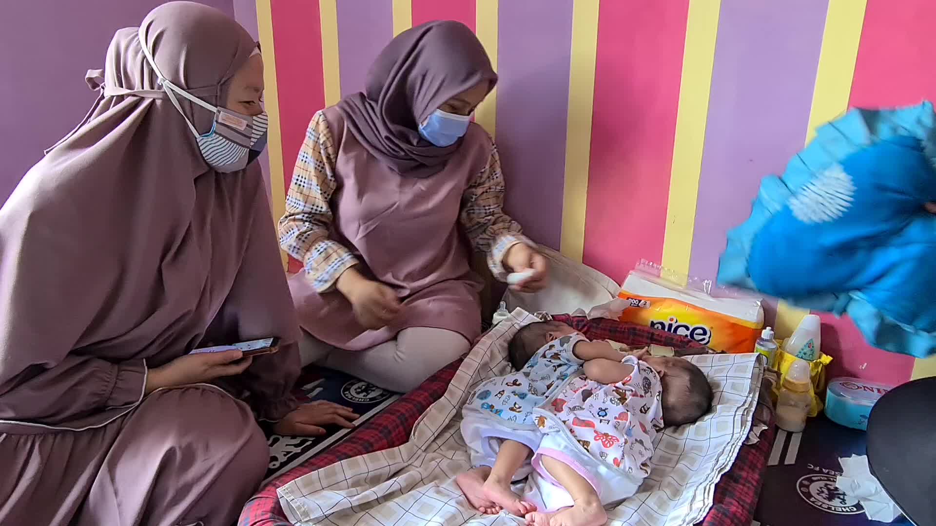 Conjoined twins Awaiting Funds for Separation Operation in Indonesia 