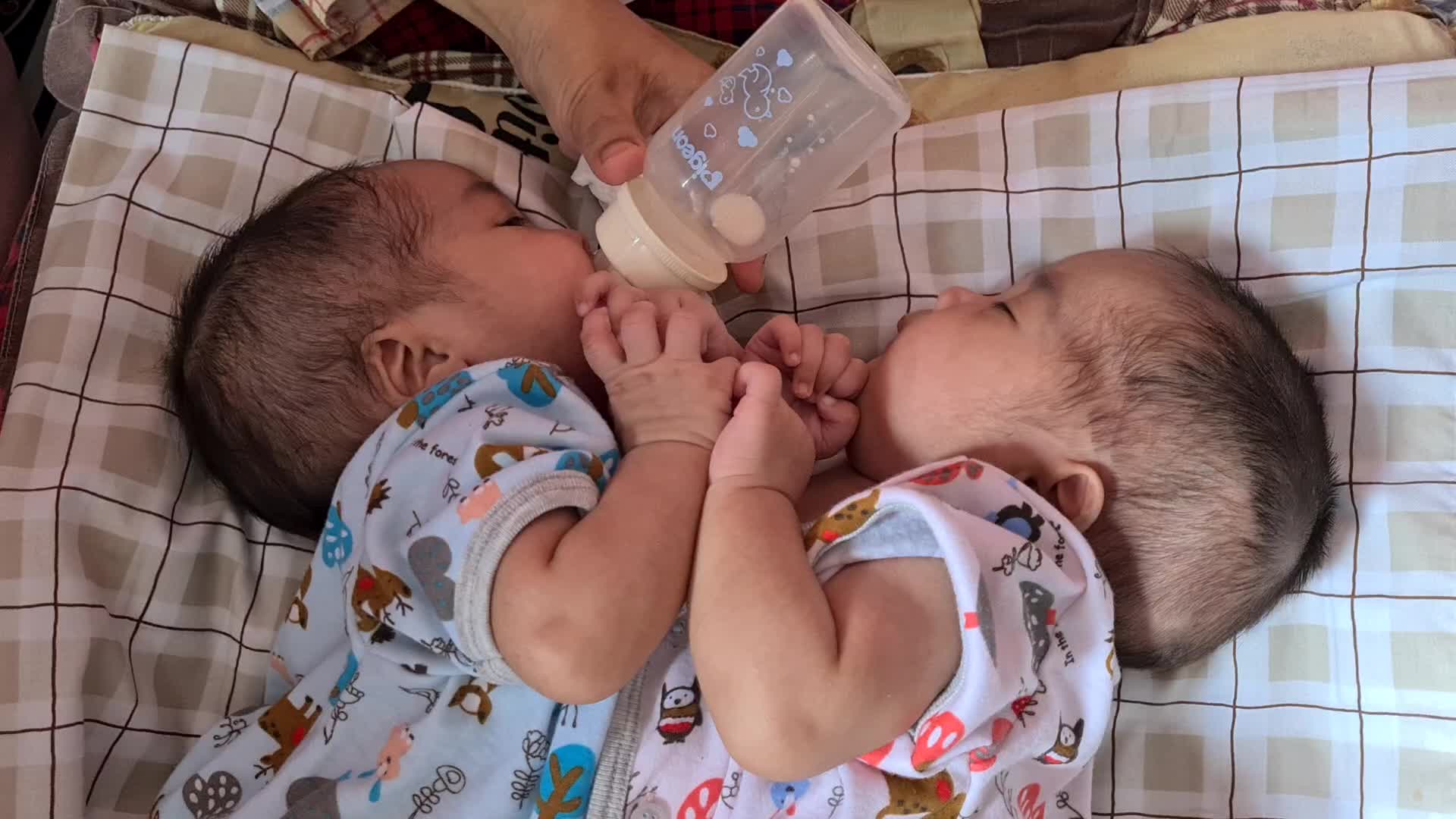 Conjoined twins Awaiting Funds for Separation Operation in Indonesia 