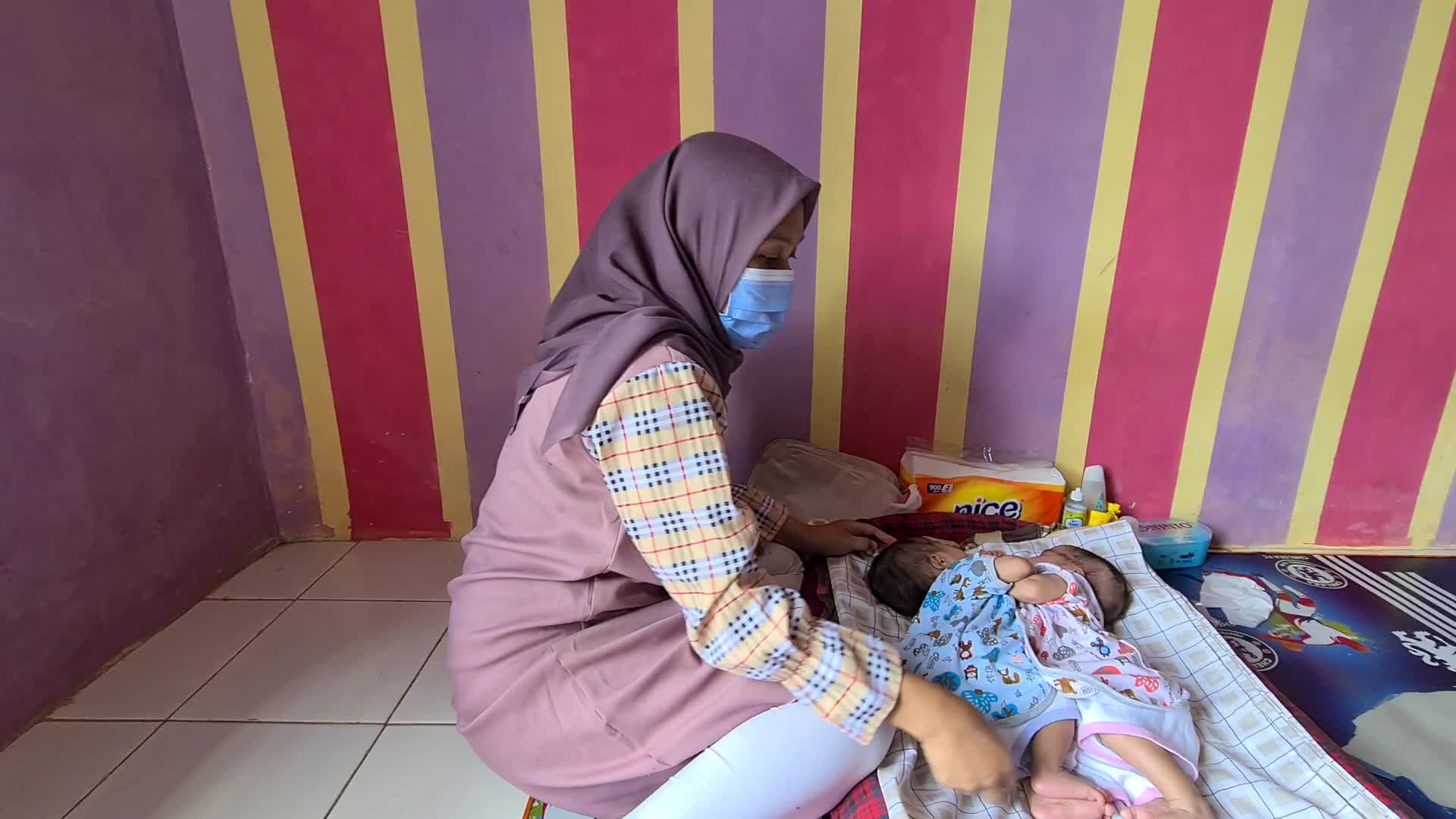 Conjoined twins Awaiting Funds for Separation Operation in Indonesia 